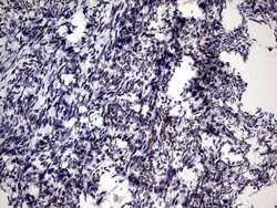 ZNF34 Mouse anti-Human, Clone: OTI3G2, lyophilized, TrueMAB 100 &mu;g;