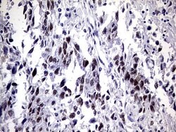 ZNF34 Mouse anti-Human, Clone: OTI3G2, lyophilized, TrueMAB 100 &mu;g;
