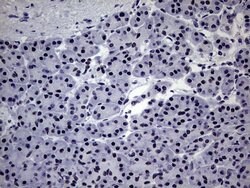 ZNF34 Mouse anti-Human, Clone: OTI3G2, lyophilized, TrueMAB 100 &mu;g;