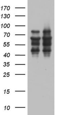 ZNF34 Mouse anti-Human, Clone: OTI3G2, lyophilized, TrueMAB 100 &mu;g;