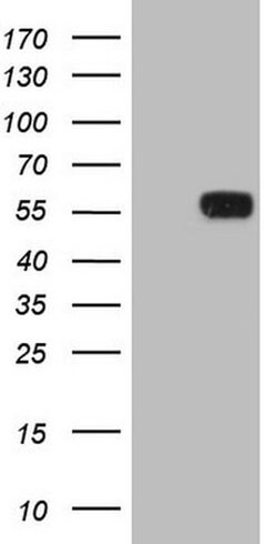 ZNF35 Monoclonal Antibody (OTI3D2), TrueMAB , OriGene 100 &mu;L | Buy Online | OriGene | Fisher Scientific
