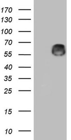 ZNF35 Monoclonal Antibody (OTI1D9), TrueMAB , OriGene:Antibodies:Primary