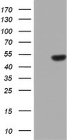 ZNF385B Mouse anti-Human, Clone: OTI1H10, lyophilized, TrueMAB 100 &mu;g;