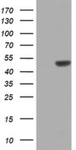ZNF385B Monoclonal Antibody (OTI2G4), TrueMAB , OriGene:Antibodies:Primary