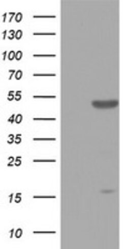ZNF385B Mouse anti-Human, Clone: OTI1E3, lyophilized, TrueMAB 100 &mu;g;