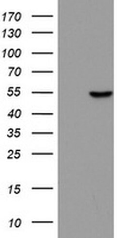 ZNF385B Monoclonal Antibody (OTI6G3), TrueMAB , OriGene 100 &mu;L; Unconjugated:Antibodies,