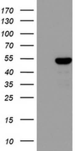 ZNF385B Monoclonal Antibody (OTI4F9), TrueMAB , OriGene:Antibodies:Primary