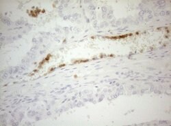 ZNF394 Monoclonal Antibody (OTI1A8), TrueMAB , OriGene:Antibodies:Primary