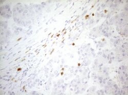 ZNF394 Monoclonal Antibody (OTI1A8), TrueMAB , OriGene 100 &mu;L; Unconjugated:Antibodies,