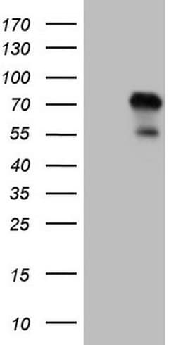 ZNF394 Monoclonal Antibody (OTI1A8), TrueMAB , OriGene:Antibodies:Primary