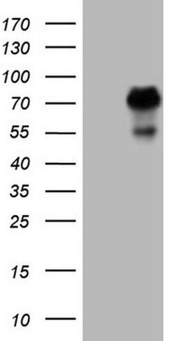 ZNF394 Monoclonal Antibody (OTI1H10), TrueMAB , OriGene 100 &mu;L | Buy Online | OriGene | Fisher Scientific
