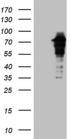 ZNF449 Monoclonal Antibody (OTI2C5), TrueMAB , OriGene:Antibodies:Primary