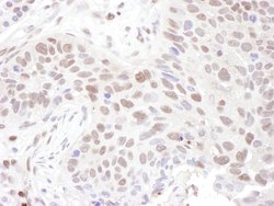 ZNF462 Rabbit anti-Human, Mouse, Polyclonal, Bethyl Laboratories 100 &mu;L;