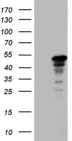 ZNF500 Monoclonal Antibody (OTI1E2), TrueMAB , OriGene:Antibodies:Primary