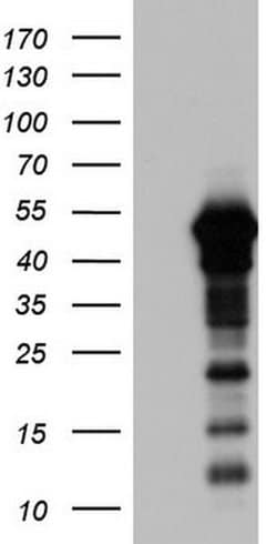 ZNF500 Monoclonal Antibody (OTI1H2), TrueMAB , OriGene:Antibodies:Primary