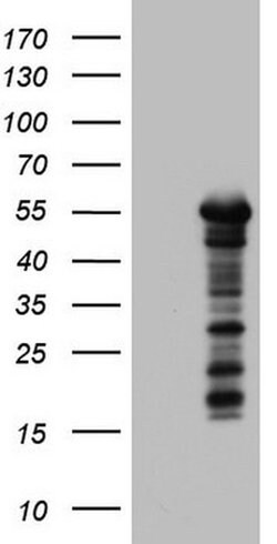 ZNF500 Monoclonal Antibody (OTI1B7), TrueMAB , OriGene:Antibodies:Primary
