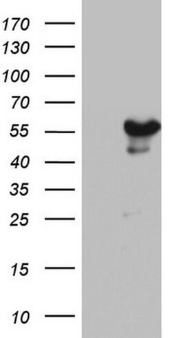 ZNF500 Monoclonal Antibody (OTI4G1), TrueMAB , OriGene:Antibodies:Primary