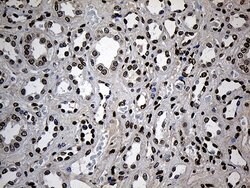 ZNF558 Mouse anti-Human, Clone: OTI2C4, lyophilized, TrueMAB 100 &mu;g;