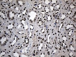 ZNF558 Monoclonal Antibody (OTI2C4), TrueMAB , OriGene 100 &mu;L; Unconjugated:Antibodies,