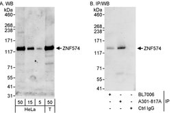 ZNF574 Rabbit anti-Human, Polyclonal, Bethyl Laboratories 100 &mu;L; Unconjugated:Antibodies,