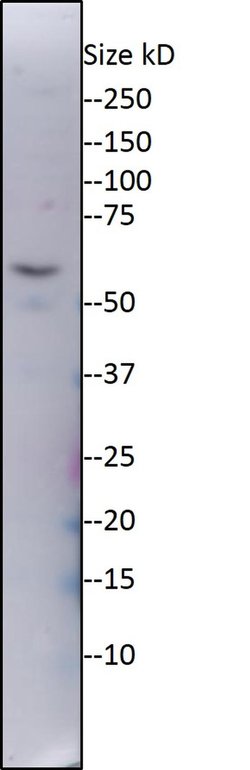 Invitrogen ZNF578 Polyclonal Antibody 100 &mu;L | Buy Online | Invitrogen&trade; | Fisher Scientific