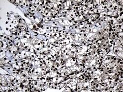 ZNF583 Monoclonal Antibody (OTI4H2), TrueMAB , OriGene 100 &mu;L; Unconjugated:Antibodies,