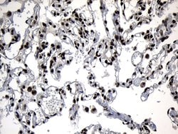 ZNF583 Monoclonal Antibody (OTI4H2), TrueMAB , OriGene:Antibodies:Primary