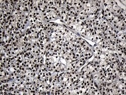 ZNF583 Mouse anti-Human, Clone: OTI4D2, lyophilized, TrueMAB 100 &mu;g;