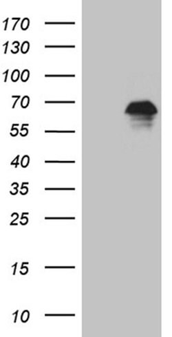 ZNF583 Monoclonal Antibody (OTI4H2), TrueMAB , OriGene 100 &mu;L; Unconjugated:Antibodies,