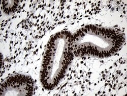 ZNF670 Mouse anti-Human, Clone: OTI6E10, lyophilized, TrueMAB 100 &mu;g;