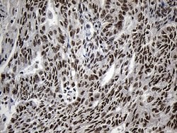 ZNF670 Mouse anti-Human, Clone: OTI6E10, lyophilized, TrueMAB 100 &mu;g;