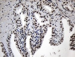 ZNF670 Mouse anti-Human, Clone: OTI6E10, lyophilized, TrueMAB 100 &mu;g;