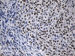 ZNF670 Mouse anti-Human, Clone: OTI6E10, lyophilized, TrueMAB 100 &mu;g;