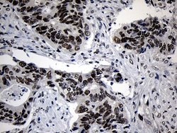 ZNF670 Mouse anti-Human, Clone: OTI6E10, lyophilized, TrueMAB 100 &mu;g;