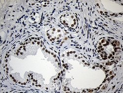ZNF670 Monoclonal Antibody (OTI3E1), TrueMAB , OriGene:Antibodies:Primary