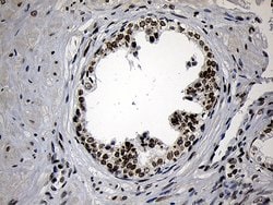 ZNF670 Monoclonal Antibody (OTI3E1), TrueMAB , OriGene:Antibodies:Primary