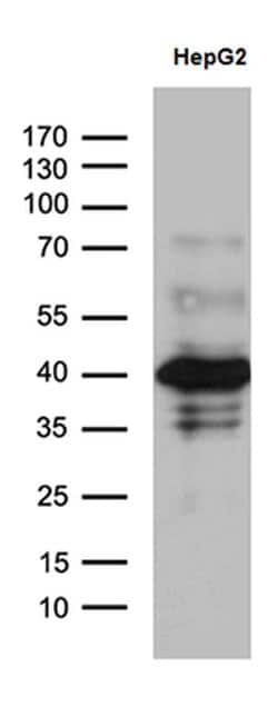 ZNF670 Monoclonal Antibody (OTI6H9), TrueMAB , OriGene:Antibodies:Primary