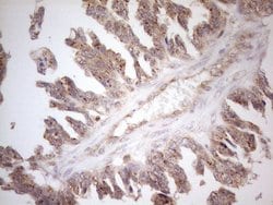 ZNF69 Monoclonal Antibody (OTI3C3), TrueMAB , OriGene 100 &mu;L; Unconjugated:Antibodies,