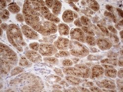 ZNF69 Monoclonal Antibody (OTI3C3), TrueMAB , OriGene 100 &mu;L; Unconjugated:Antibodies,