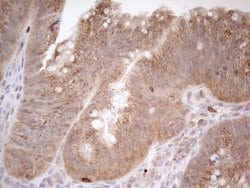 ZNF69 Monoclonal Antibody (OTI3C3), TrueMAB , OriGene 100 &mu;L; Unconjugated:Antibodies,