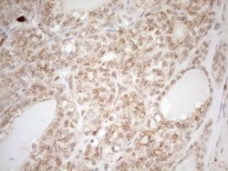 ZNF69 Monoclonal Antibody (OTI3C3), TrueMAB , OriGene 100 &mu;L; Unconjugated:Antibodies,