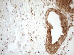 ZNF69 Monoclonal Antibody (OTI3C3), TrueMAB , OriGene:Antibodies:Primary
