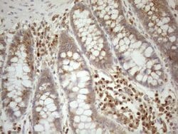ZNF69 Monoclonal Antibody (OTI3C3), TrueMAB , OriGene 100 &mu;L; Unconjugated:Antibodies,