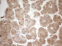 ZNF69 Monoclonal Antibody (OTI3C3), TrueMAB , OriGene 100 &mu;L; Unconjugated:Antibodies,