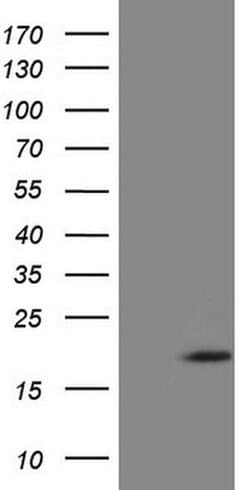 ZNF69 Monoclonal Antibody (OTI3C3), TrueMAB , OriGene:Antibodies:Primary