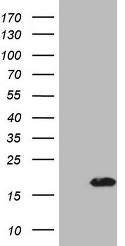 ZNF69 Monoclonal Antibody (OTI4D9), TrueMAB , OriGene 100 &mu;L; Unconjugated:Antibodies,