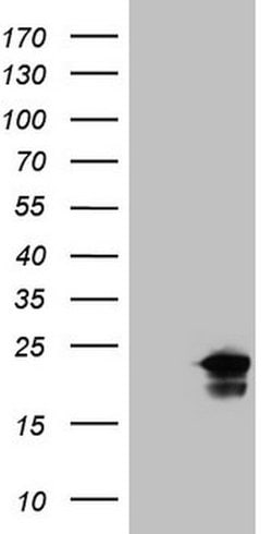 ZNF69 Mouse anti-Human, Clone: OTI4A4, lyophilized, TrueMAB 100 &mu;g;