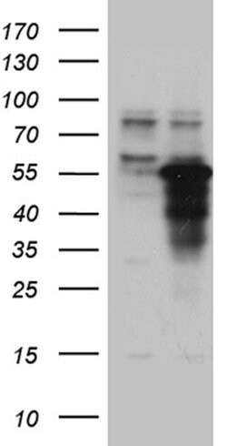 ZNF718 Mouse anti-Human, Clone: OTI1D3, lyophilized, TrueMAB 100 &mu;g;