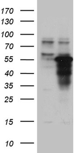 ZNF718 Monoclonal Antibody (OTI1D3), TrueMAB , OriGene:Antibodies:Primary