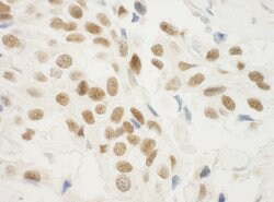 ZNF768 Rabbit anti-Human, Polyclonal, Bethyl Laboratories 100 &mu;L; Unconjugated:Antibodies,